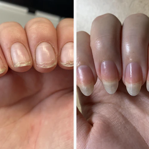 Sérum pour ongles UltraGrow