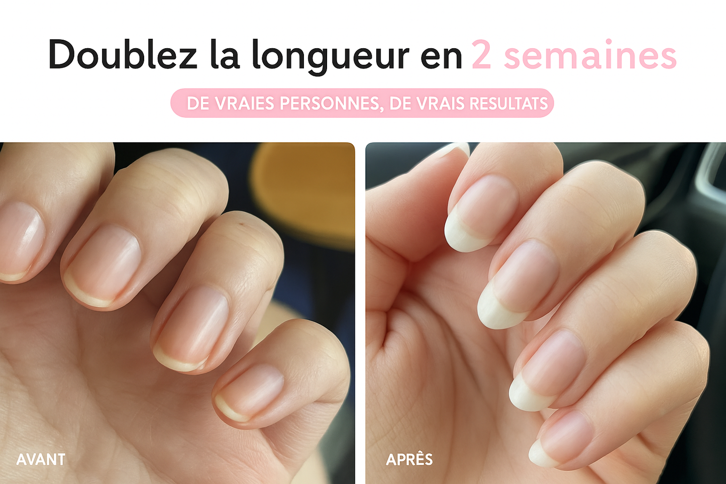 Sérum pour ongles UltraGrow