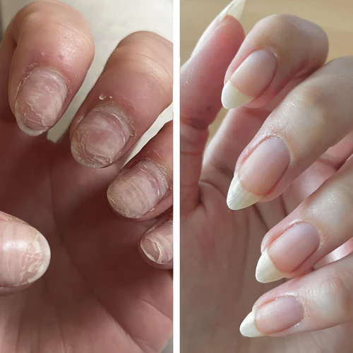 Sérum pour ongles UltraGrow