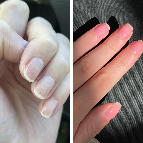 Sérum pour ongles UltraGrow